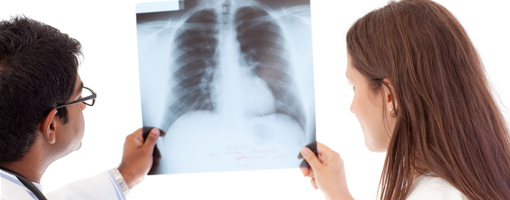 drexel pulmonary medicine xray
